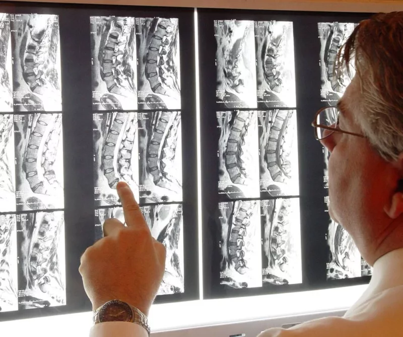 dr lee quiropráctico mirando radiografías